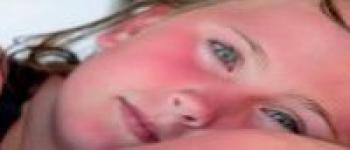 Se protéger du soleil